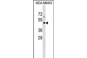 Western blot analysis in MDA-MB453 cell line lysates (35ug/lane). (MR1 antibody  (C-Term))