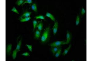 Immunofluorescence staining of Hela cells with ABIN7152702 at 1:166, counter-stained with DAPI. (FERMT2 antibody  (AA 155-232))