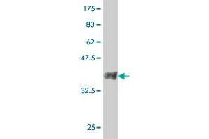 Western Blot detection against Immunogen (38. (Slc26a9 antibody  (AA 496-605))