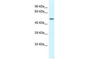 Image no. 1 for anti-Vitamin D-Binding Protein (GC) (AA 70-119) antibody (ABIN6747593) (Vitamin D-Binding Protein antibody  (AA 70-119))
