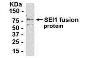 Western Blotting (WB) image for anti-SERTA Domain Containing 1 (SERTAD1) (AA 1-236) antibody (ABIN2468083) (SERTAD1 antibody  (AA 1-236))