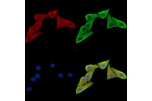 ABIN7095240 and ABIN7099297 staining Hela cells by IF/ICC. (NEXN antibody)