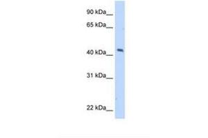 Image no. 1 for anti-Melanoma Antigen Family A, 1 (Directs Expression of Antigen MZ2-E) (MAGEA1) (AA 201-250) antibody (ABIN321051) (MAGEA1 antibody  (AA 201-250))