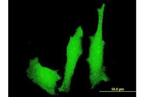 Immunofluorescence of monoclonal antibody to LMO4 on HeLa cell. (LMO4 antibody  (AA 1-165))
