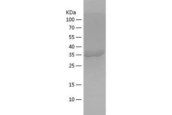 Acetyl-CoA Carboxylase alpha Protein (ACACA) (AA 2223-22346) (His-IF2DI Tag)