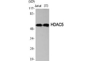 Western Blotting (WB) image for anti-Histone Deacetylase 2 (HDAC2) (Ser394) antibody (ABIN5956848) (HDAC2 antibody  (Ser394))