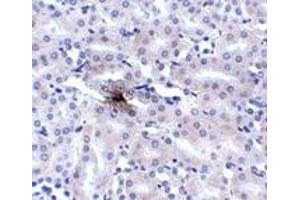 Immunohistochemistry (IHC) image for anti-Solute Carrier Family 39 (Metal Ion Transporter), Member 11 (SLC39A11) (Middle Region) antibody (ABIN1031177) (SLC39A11 antibody  (Middle Region))