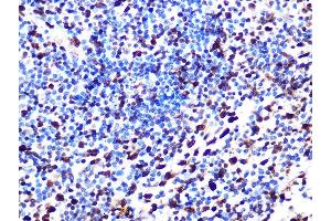 Immunohistochemistry of paraffin-embedded human appendix using S Rabbit mAb (ABIN7270142) at dilution of 1:100 (40x lens). (SAMHD1 antibody)