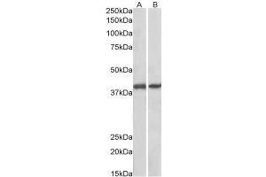 AP23750PU-N GNAQ antibody staining of Pig Colon (A) and Pig Spleen (B) lysates at 0. (GNAQ antibody  (Internal Region))