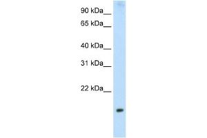 WB Suggested Anti-PPP1R8 Antibody Titration:  2.