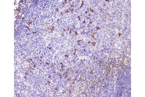 IHC analysis of CXCL12 using anti-CXCL12 antibody (ABIN6719467). (CXCL12 antibody  (AA 24-93))