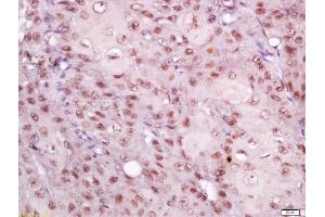 Immunohistochemistry (Paraffin-embedded Sections) (IHC (p)) image for anti-Eukaryotic Translation Initiation Factor 3, Subunit G (EIF3G) (AA 51-150) antibody (ABIN2559611)