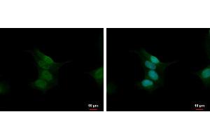 ICC/IF Image Calcineurin A antibody detects Calcineurin A protein at nucleus by immunofluorescent analysis. (Calcineurin A antibody  (Center))