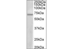 PRMT3 Antibody  staining of MCF7 lysate at 1 μg/ml (35 μg protein in RIPA buffer). (PRMT3 antibody  (Internal Region))