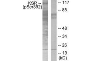 Western blot analysis of extracts from HepG2 cells, using KSR (Phospho-Ser392) Antibody. (KSR1 antibody  (pSer404))