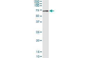 Immunoprecipitation of STK33 transfected lysate using anti-STK33 MaxPab rabbit polyclonal antibody and Protein A Magnetic Bead , and immunoblotted with STK33 purified MaxPab mouse polyclonal antibody (B01P) . (STK33 antibody  (AA 1-514))