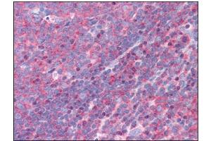 Human Tonsil: Formalin-Fixed, Paraffin-Embedded (FFPE) (FNBP1 antibody  (Internal Region))