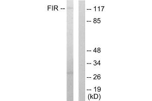 Western blot analysis of extracts from HuvEc cells, using FIR antibody.