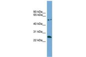 Image no. 1 for anti-Ethylmalonic Encephalopathy 1 (ETHE1) (AA 92-141) antibody (ABIN6745499) (ETHE1 antibody  (AA 92-141))