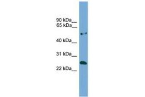 Image no. 1 for anti-Ethylmalonic Encephalopathy 1 (ETHE1) (AA 92-141) antibody (ABIN6745499)