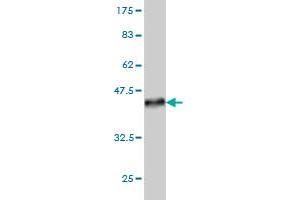 Western Blot detection against Immunogen (36. (LIM Domain Kinase 1 antibody  (AA 548-647))