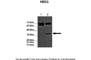 Lanes:   Lane 1: 15ug WT mouse ES lysate Lane 2: 15ug MBD2 KO mouse ES lysate  Primary Antibody Dilution:   1:1000  Secondary Antibody:   Goat anti-rabbit-HRP  Secondary Antibody Dilution:   1:2500  Gene Name:   MBD2 a  Submitted by:   Austin J. (MBD2 antibody  (N-Term))