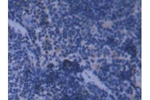 DAB staining on IHC-P; Samples: Mouse Spleen Tissue (FTL antibody  (AA 5-183))