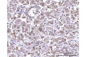 IHC analysis of RNGTT using anti-RNGTT antibody (ABIN7599723). (RNGTT antibody  (AA 11-438))