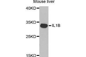 Western blot analysis of extracts of mouse liver, using IL1B antibody (ABIN5970463) at 1/1000 dilution. (IL-1 beta antibody)
