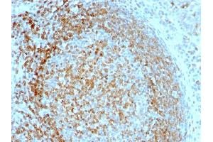 Immunohistochemistry (IHC) image for anti-HLA-DR-gamma (CD74) antibody (ABIN6941253)