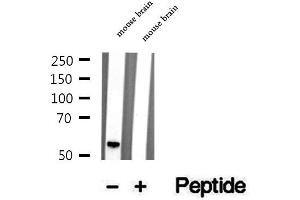 Western blot analysis of extracts of mouse brain tissue, using STAU1 antibody. (STAU1/Staufen antibody  (Internal Region))