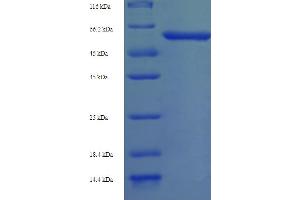 SDS-PAGE (SDS) image for Protein Abscisic Acid-Insensitive 5 (ABI5) (AA 1-442), (full length) protein (His-SUMO Tag) (ABIN5711873) (ABI5 Protein (AA 1-442, full length) (His-SUMO Tag))