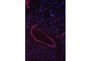 anti-Caveolin 1, Caveolae Protein, 22kDa (CAV1) (AA 4-178) antibody