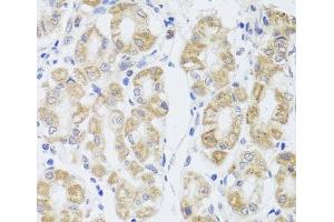 Immunohistochemistry of paraffin-embedded Human stomach using MIP Polyclonal Antibody at dilution of 1:100 (40x lens). (Mip antibody)