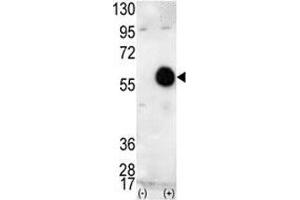 Western blot analysis of AKT2 antibody and 293 cell lysate (2 ug/lane) either nontransfected (Lane 1) or transiently transfected with the human gene (2). (AKT2 antibody  (AA 416-444))