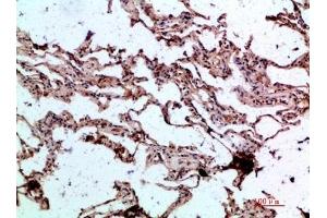 Immunohistochemical analysis of paraffin-embedded human-lung, antibody was diluted at 1:200. (GDF2 antibody  (AA 371-420))