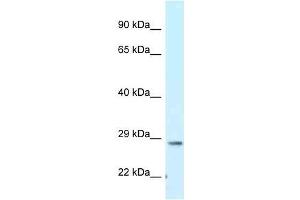 Western Blot showing Tmem106b antibody used at a concentration of 1. (TMEM106B antibody  (C-Term))