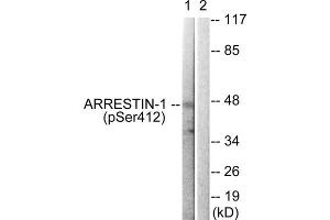 Western blot analysis of extracts from COS7 cells, treated with Etoposide (25uM, 60mins), using ARRB1 (Phospho-Ser412) antibody. (beta Arrestin 1 antibody  (pSer412))