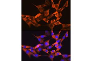 Immunofluorescence analysis of NIH-3T3 cells using F Rabbit mAb (ABIN7267150) at dilution of 1:100 (40x lens). (FABP1 antibody)