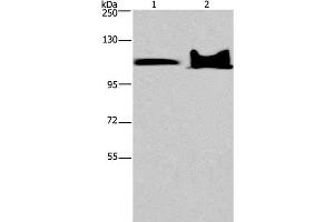 Western Blot analysis of Mouse heart and brain tissue using KDM4C Polyclonal Antibody at dilution of 1:800