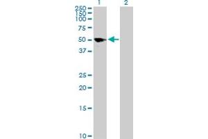 Western Blot analysis of GFAP expression in transfected 293T cell line by GFAP MaxPab polyclonal antibody. (GFAP antibody  (AA 1-432))