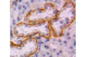 #VALUE! (CUBN antibody  (AA 3157-3274))