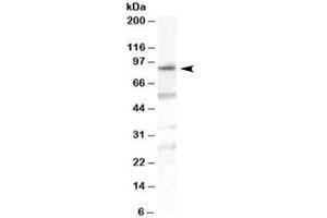 Western blot testing of human duodenum lysate with OSBPL10 antibody at 1ug/ml. (OSBPL10 antibody)