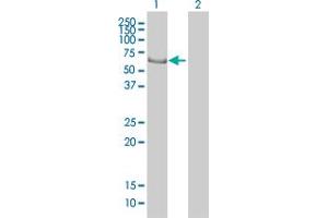 Western Blot analysis of EHD4 expression in transfected 293T cell line by EHD4 monoclonal antibody (M01), clone 1B8.