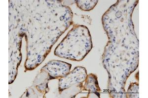 Immunoperoxidase of monoclonal antibody to CLIC5 on formalin-fixed paraffin-embedded human placenta. (CLIC5 antibody  (AA 91-190))