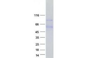 PRELP Protein (Transcript Variant 2) (Myc-DYKDDDDK Tag)