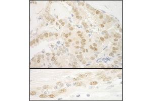 anti-MKL/myocardin-Like 2 (MKL2) (AA 1038-1088) antibody