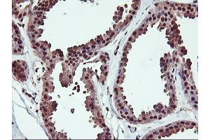Immunohistochemical staining of paraffin-embedded Human breast tissue using anti-SAMHD1 mouse monoclonal antibody. (SAMHD1 antibody)