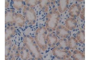 DAB staining on IHC-P; Samples: Mouse Kidney Tissue (PTX3 antibody  (AA 183-381))