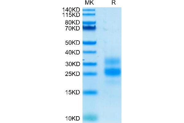 ICOS Protein (AA 21-134) (His tag)